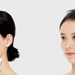 korean plastic surgery