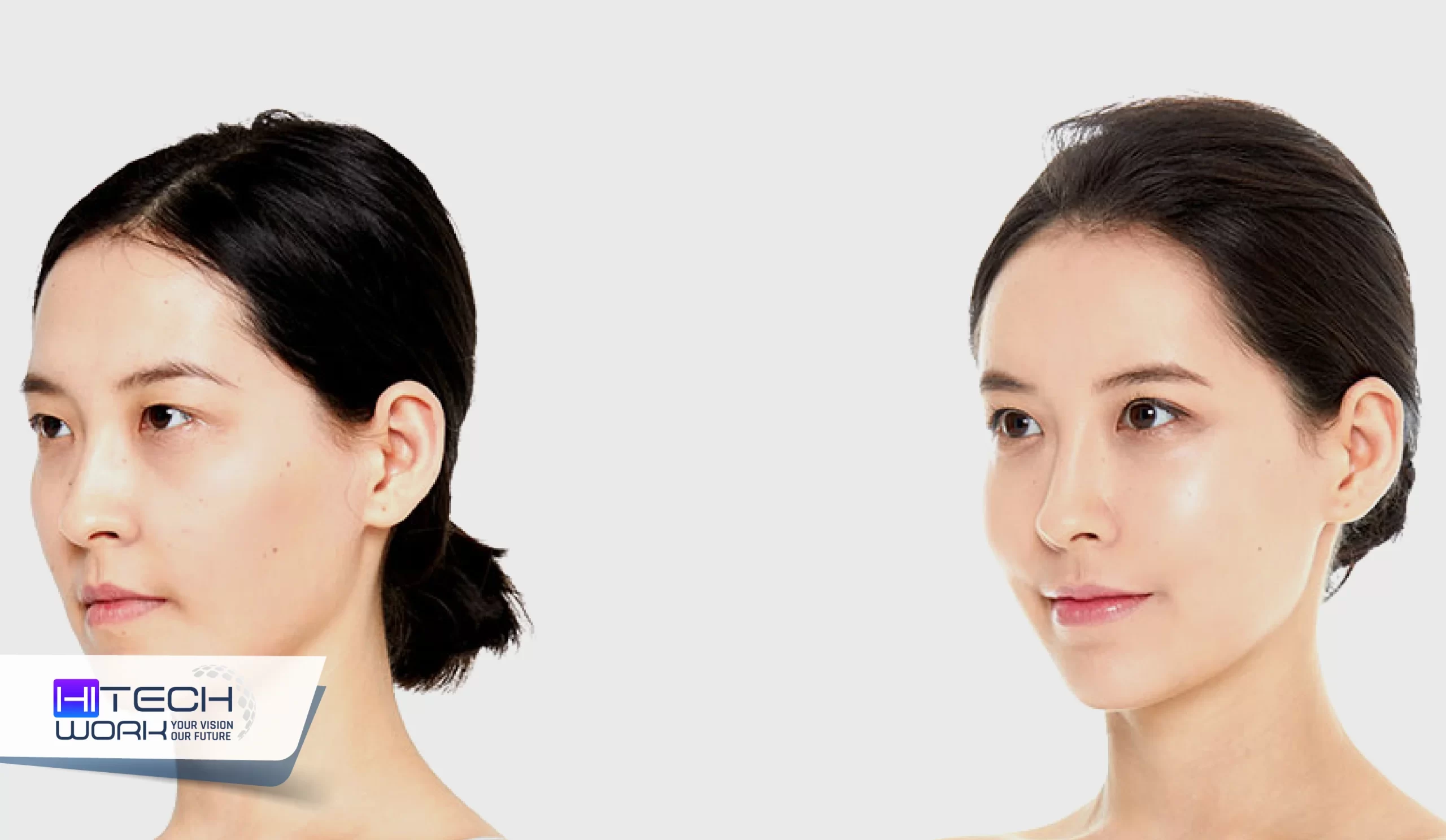 korean plastic surgery